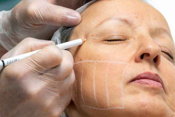 CryoPen: 5 Skin Concerns It May Be Used to Treat 4 What should you ask before having CryoPen treatment Tyne and Wear?