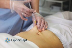 Does Skin Sag After Fat Dissolving Injections? 2 Do you want to get Aqualyx fat dissolving injections Tyne and Wear but worried about loose skin afterwards?
