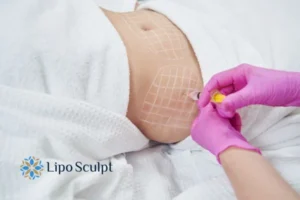 Are The Results From Aqualyx Permanent? 1 Do you want to know how long Aqualyx Tyne and Wear results last?