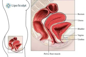 Treatment For A Leaky Bladder 2 How EM Chair treatment Tyne and Wear can help Leaky bladder issues. Read more now!