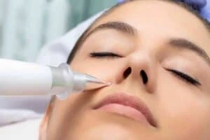 Best Actinic Keratoses Removal 3 Actinic keratoses Tyne and Wear solutions - book in today!
