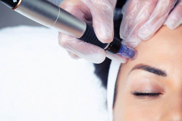Explaining Total Skin Tightening Treatment and What to Expect 2 What Skin Concerns Can Total Skin Tightening Treatment Help With Tyne and Wear?