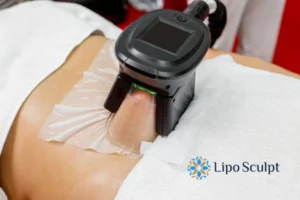 Does Fat Freezing At Home Work? 3 Fat freezing at home from Lipo Sculpt Tyne and Wear